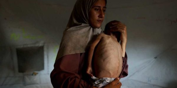 famine in gaza