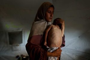 famine in gaza